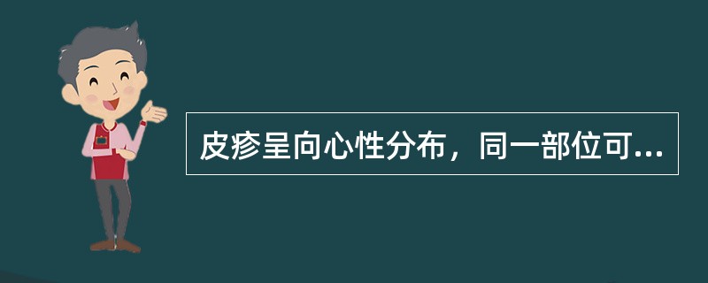 皮疹呈向心性分布，同一部位可见不同性状皮疹的是（）