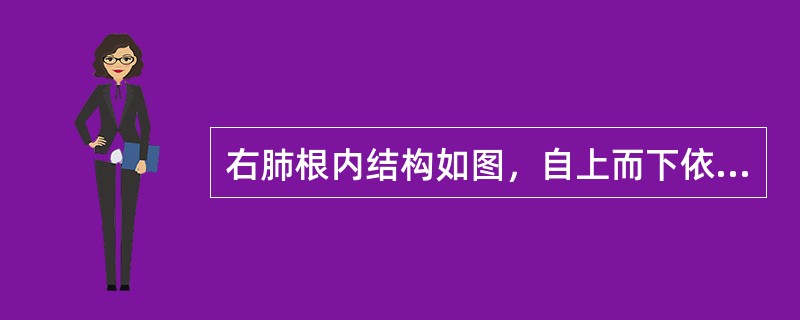 右肺根内结构如图，自上而下依次为（）