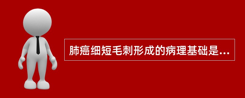 肺癌细短毛刺形成的病理基础是（）