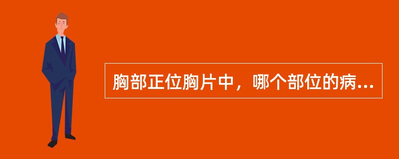 胸部正位胸片中，哪个部位的病变不易被观察到（）