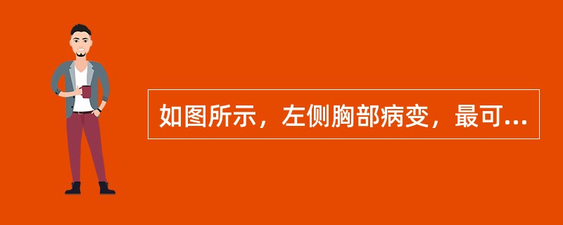 如图所示，左侧胸部病变，最可能的诊断为（）