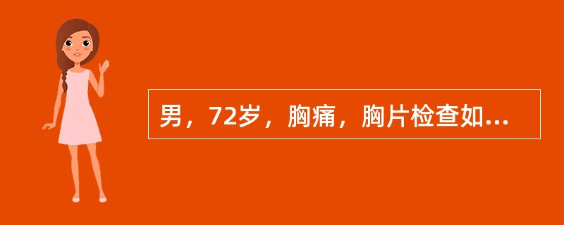 男，72岁，胸痛，胸片检查如图，最可能的诊断是（）