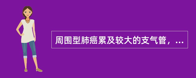 周围型肺癌累及较大的支气管，以下列哪种类型的癌多见（）