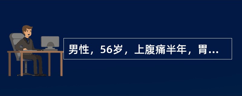 男性，56岁，上腹痛半年，胃肠道造影图像见图7-38，X线诊断为（）。