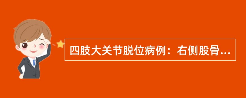 四肢大关节脱位病例：右侧股骨颈骨折病例摘要：患者，女性，75岁，右髋外伤后5小时