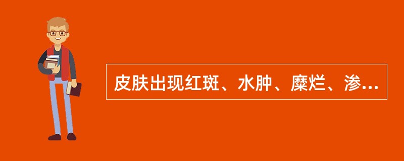 皮肤出现红斑、水肿、糜烂、渗液，外用药首选（）