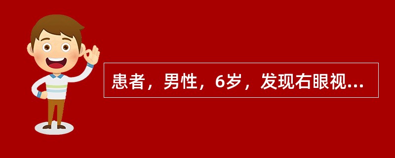 患者，男性，6岁，发现右眼视力差2个月。Vod指数／10cm，右眼压33mmHg