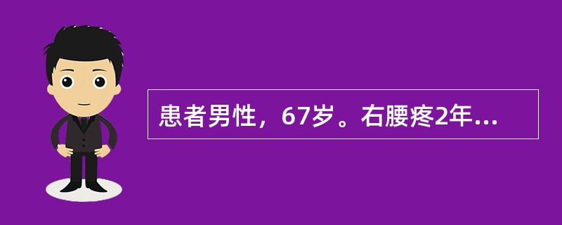 患者男性，67岁。右腰疼2年余，无痛性全程肉眼血尿3天。查体：右肾区叩痛，季肋下