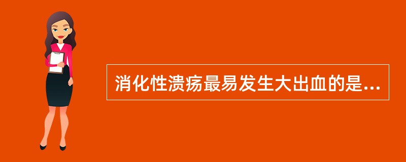 消化性溃疡最易发生大出血的是A、胃小弯溃疡B、幽门管溃疡C、十二指肠溃疡D、球后