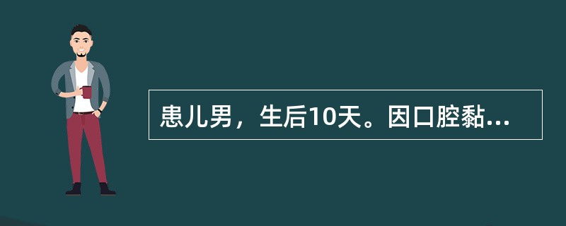 患儿男，生后10天。因口腔黏膜有异常来院就诊。查体可见口腔黏膜有白色乳凝块样小点