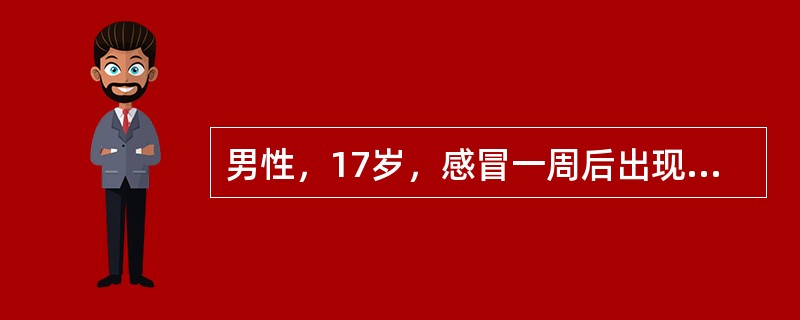 男性，17岁，感冒一周后出现颜面及双下肢水肿。查体：血压140£¯90mmHg。