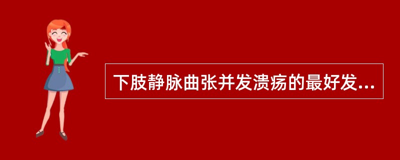 下肢静脉曲张并发溃疡的最好发部位是A、足趾末端B、足背内侧C、足背外侧D、踝周及