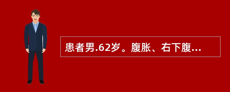 患者男.62岁。腹胀、右下腹部隐痛6个月。阵发性隐痛、乏力、消瘦，近3个月贫血。