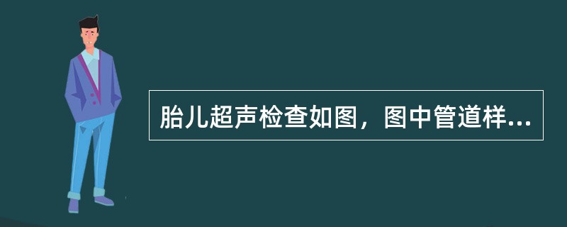 胎儿超声检查如图，图中管道样结构是（）。