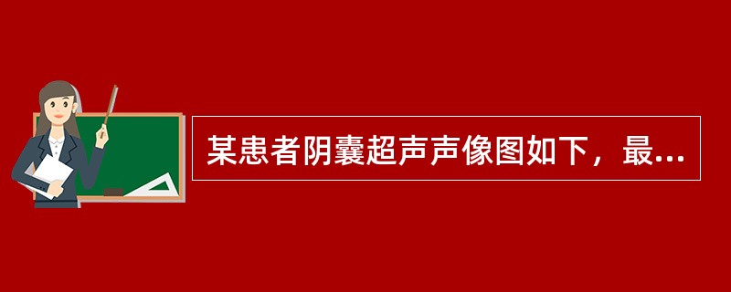 某患者阴囊超声声像图如下，最可能的诊断为（）。