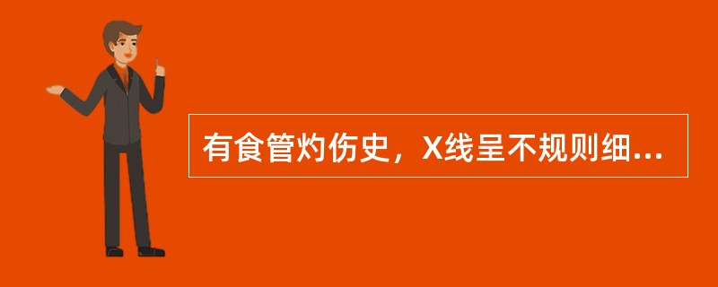 有食管灼伤史，X线呈不规则细线状狭窄（）