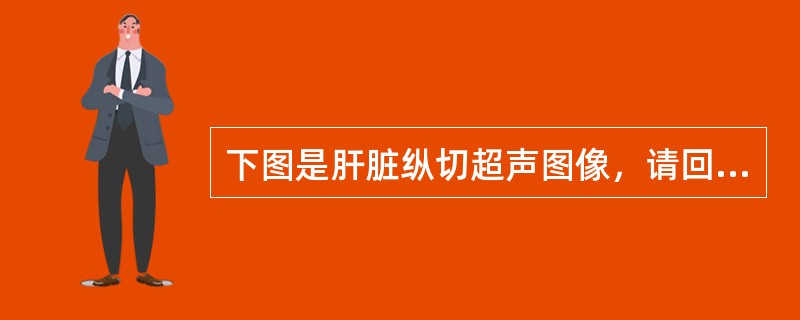 下图是肝脏纵切超声图像，请回答箭头所指部位的解剖名称（）。