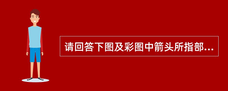 请回答下图及彩图中箭头所指部位的解剖名称（）。