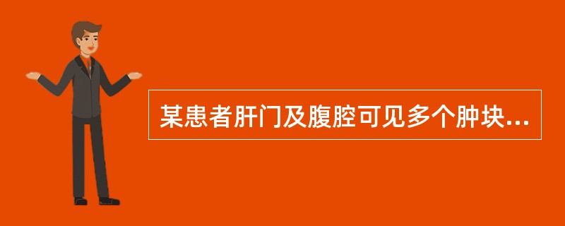 某患者肝门及腹腔可见多个肿块回声。根据声像图表现，最可能的诊断是（）。