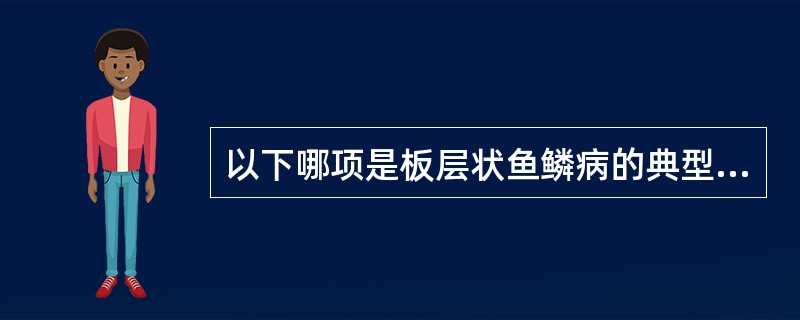 以下哪项是板层状鱼鳞病的典型皮损为()