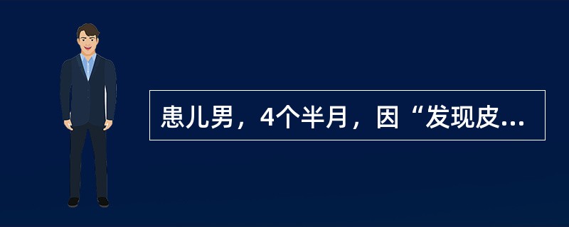 患儿男，4个半月，因“发现皮肤黄疸2周”来诊。查体：皮肤、巩膜中度黄染；肝肋下2