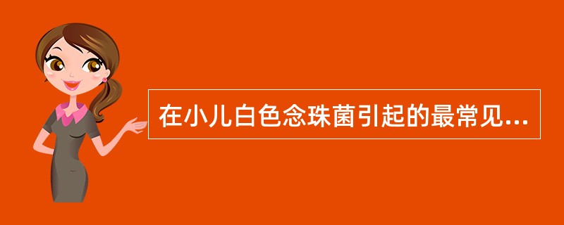 在小儿白色念珠菌引起的最常见的感染是（）