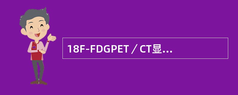 18F-FDGPET／CT显像在淋巴瘤的诊断中出现假阳性的原因有（）。