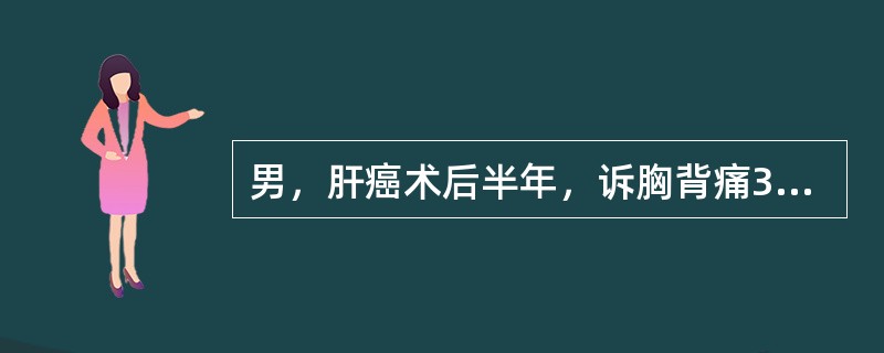 男，肝癌术后半年，诉胸背痛3个月，行Tc-MDP骨显像如图，可能的诊断是()