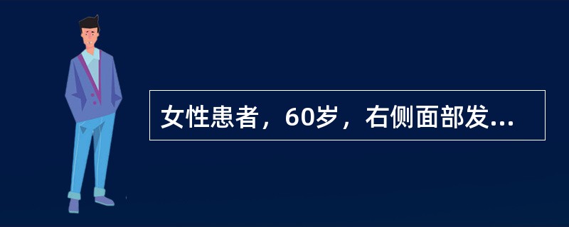 女性患者，60岁，右侧面部发作性剧痛2年，疼痛自上唇始，延至外眦下方，每次持续数