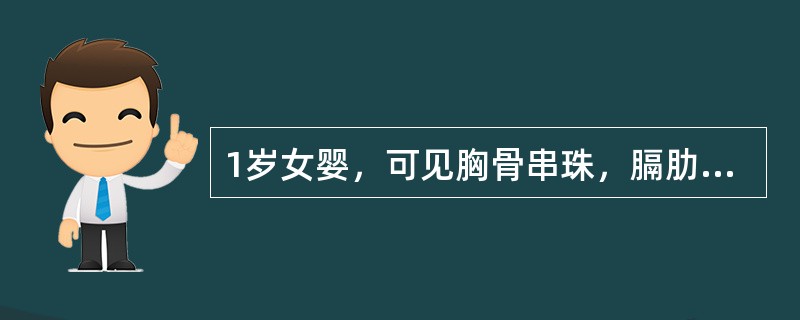 1岁女婴，可见胸骨串珠，膈肋沟、手镯有脚镯，前囟为1.5cm×1.5cm，血钙为