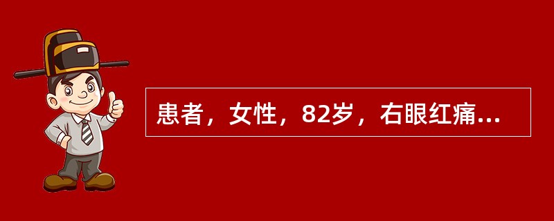 患者，女性，82岁，右眼红痛2天，检查右眼视力：FC/1Ocm，光方向准确，结膜