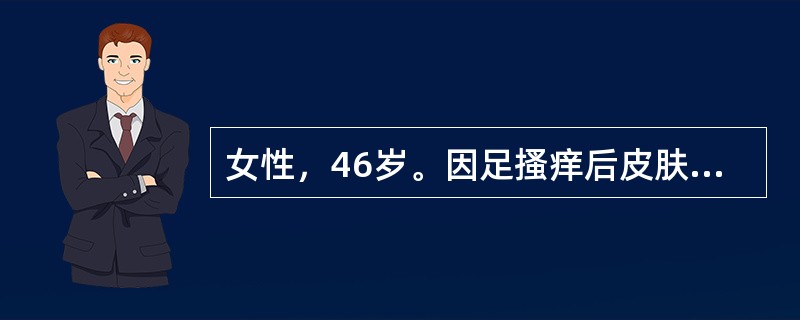 女性，46岁。因足搔痒后皮肤破溃3天入院。查体见小腿及大腿中下段出现一红线，压痛