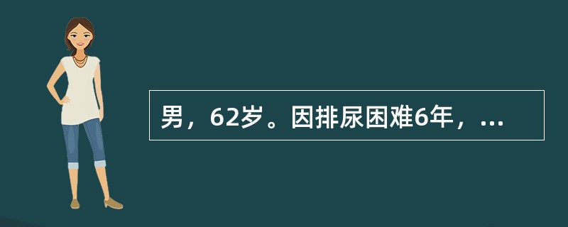 男，62岁。因排尿困难6年，不能排尿1天来诊。查下腹部扪及囊性包块，直肠指诊前列