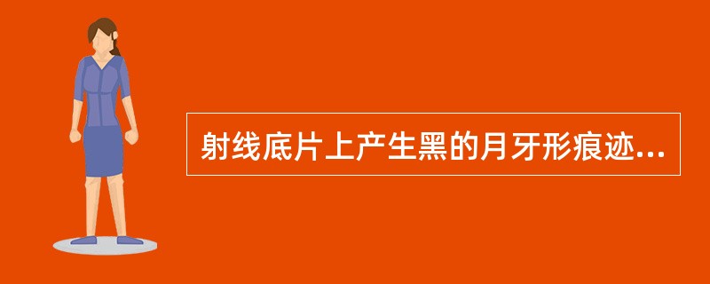 射线底片上产生黑的月牙形痕迹的原因可能是曝光后使胶片弯曲。