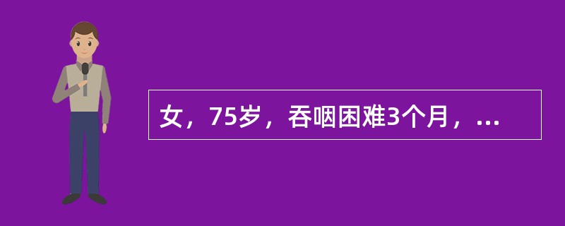 女，75岁，吞咽困难3个月，行食管钡餐检查，如图所示，最可能的诊断为（）