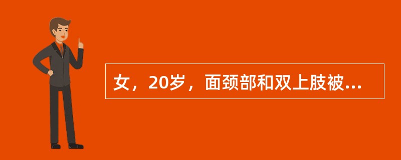 女，20岁，面颈部和双上肢被火焰烧伤，面颈部较肿胀，散在大小不等水疱；腐皮大部分