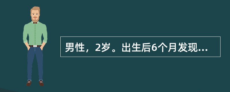 男性，2岁。出生后6个月发现头颅增大，并逐渐加重就诊。体检：神志清，仅能叫爸、妈