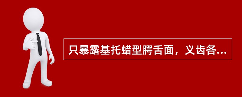 只暴露基托蜡型腭舌面，义齿各部分均包埋固定在下半盒内的装盒方法称（）