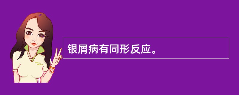 银屑病有同形反应。