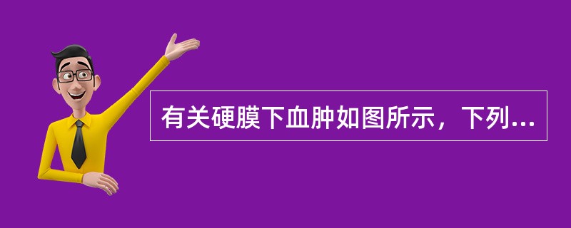 有关硬膜下血肿如图所示，下列哪项描述不恰当()