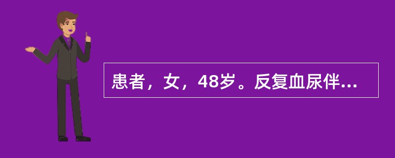 患者，女，48岁。反复血尿伴右侧腰痛7个月。CT扫描图像见图。最有可能的诊断是（