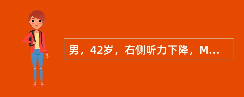 男，42岁，右侧听力下降，MRI检查如图，最可能的诊断为（）