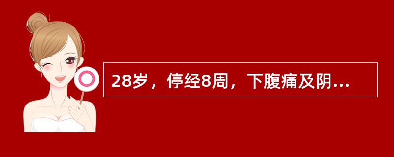 28岁，停经8周，下腹痛及阴道出血3天，血量少于月经量，未见明显组织物排出。妇科