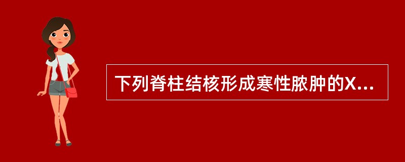 下列脊柱结核形成寒性脓肿的X线表现特征中，不正确的是（）