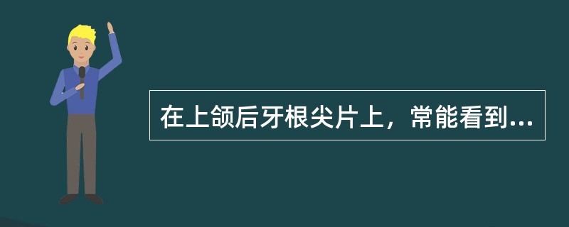 在上颌后牙根尖片上，常能看到的颌骨解剖标志是（）