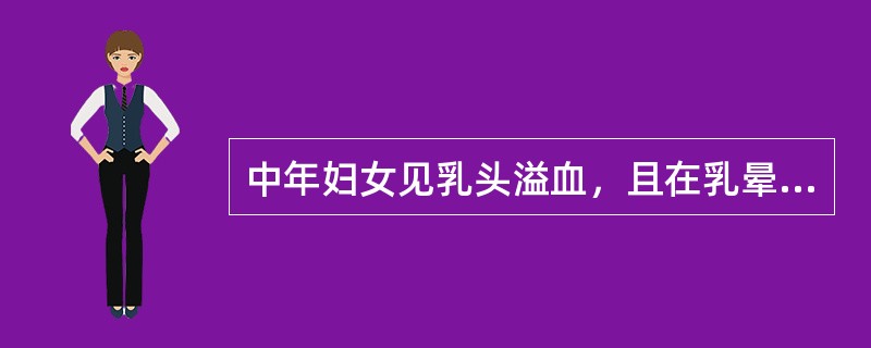 中年妇女见乳头溢血，且在乳晕部可触及小肿块，压迫肿块可见血性液体从乳头溢出，应首