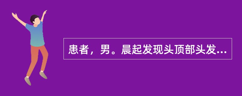 患者，男。晨起发现头顶部头发成片脱落，脱发区呈圆形，皮肤光滑而亮。应诊断为（）