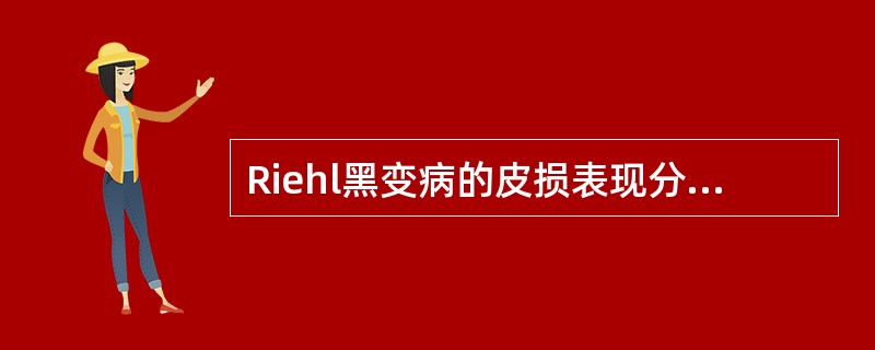 Riehl黑变病的皮损表现分哪三个期