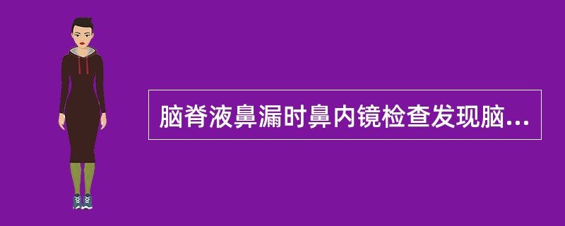 脑脊液鼻漏时鼻内镜检查发现脑脊液来自蝶筛隐窝，提示瘘孔在