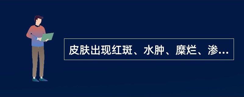 皮肤出现红斑、水肿、糜烂、渗液，外用药首选